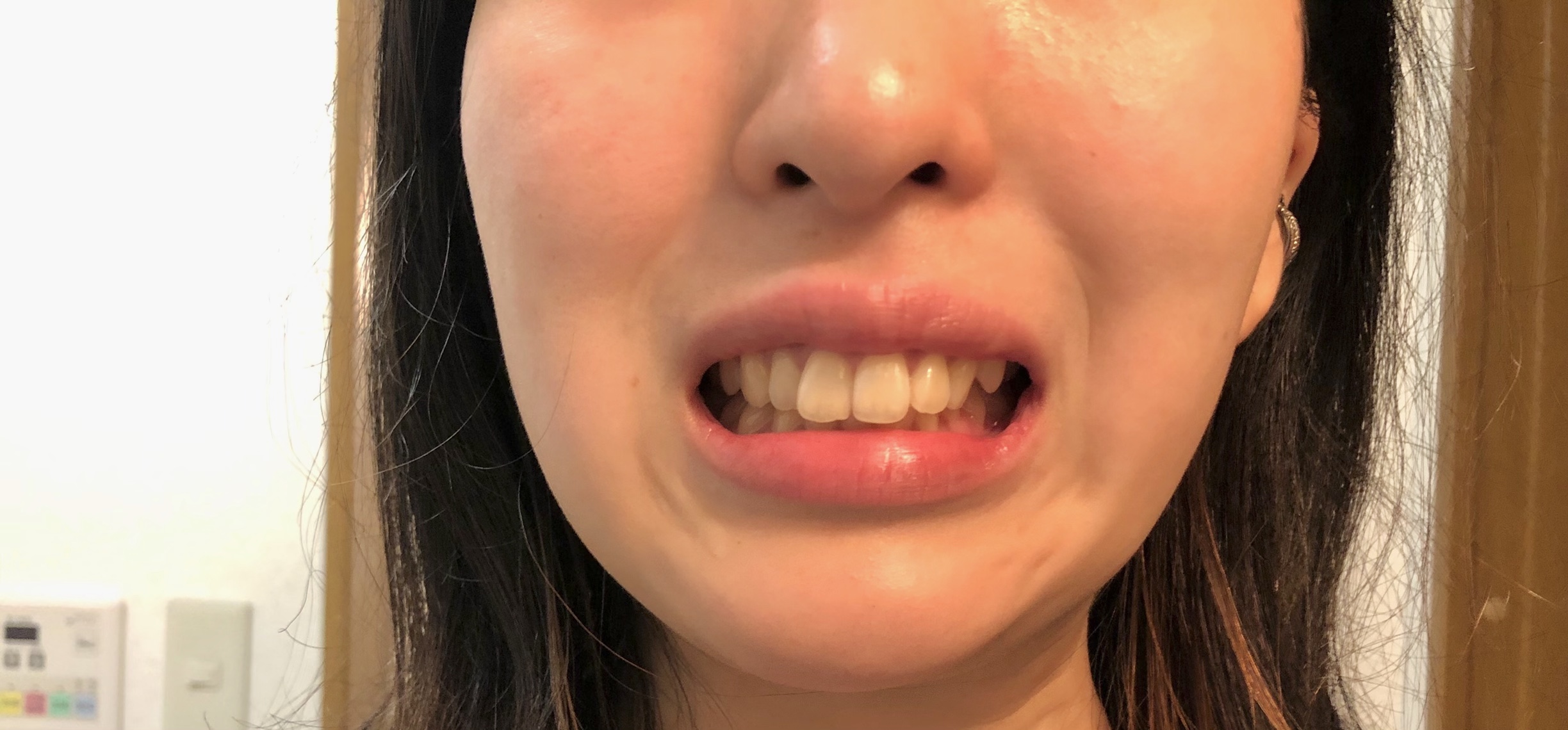 人の顔が非対称になる原因は何ですか?